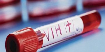 Estudio francés abrió una puerta para acabar con el VIH