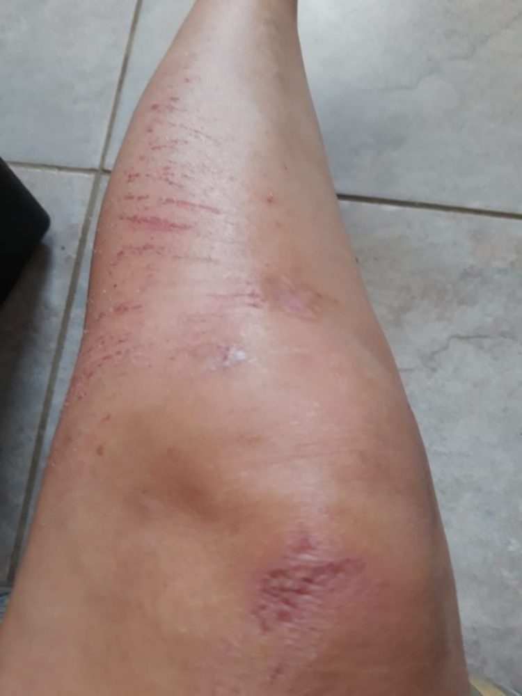 Ex policía de Trujillo fue preso en Aruba por golpear a su pareja