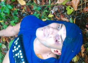 Localizan sujeto con tiro en el ojo en municipio Sucre