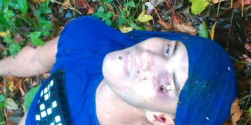 Localizan sujeto con tiro en el ojo en municipio Sucre