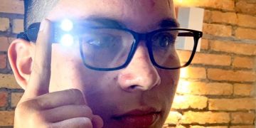 Rufo Chacón ya tiene prótesis oculares y su dispositivo de inteligencia artificial