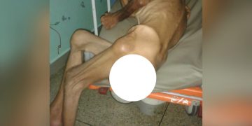 Familiares abandonan a anciano en el Hospital Central de Valera 