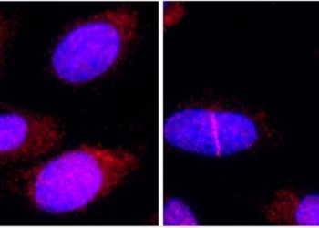 Una proteína que ayuda a reparar el ADN podría potenciar la quimioterapia
