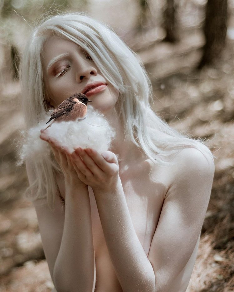 Fotografía de archivo personal, sin fecha específica, cedida por la modelo albina Ruby Vizcarra durante una de sus sesiones de fotos, en México. EFE/ Ruby Vizcarra