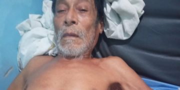 Anciano clama por ayuda para tratamiento médico en Hospital de Valera luego de sufrir caída 