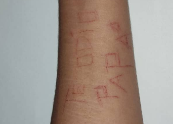 “Te odio papá”: Se marcó el brazo con una hojilla tras ser abusada sexualmente en Portuguesa