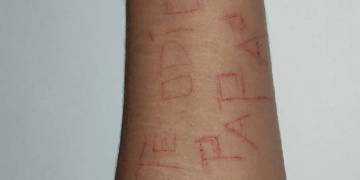 “Te odio papá”: Se marcó el brazo con una hojilla tras ser abusada sexualmente en Portuguesa