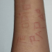 “Te odio papá”: Se marcó el brazo con una hojilla tras ser abusada sexualmente en Portuguesa