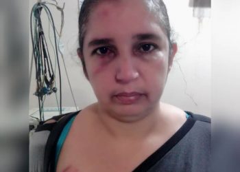 Señalan al alcalde José Leonardo Chirinos de «mandar» a golpear a mujer concejal del PSUV