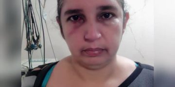 Señalan al alcalde José Leonardo Chirinos de «mandar» a golpear a mujer concejal del PSUV