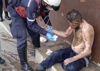 Quemado en 61% de su cuerpo resultó un indigente luego de presuntamente ser rociado por gasolina y encendido