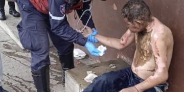 Quemado en 61% de su cuerpo resultó un indigente luego de presuntamente ser rociado por gasolina y encendido