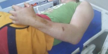 Táchira: Casi todos los 53 mordidos por serpientes este año compraron suero antiofídico porque no había en el hospital