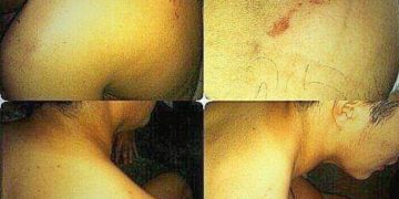 Fernando Márquez: «Por órdenes de Vielma Mora  colocaron corriente y nos colgaron con mecates»