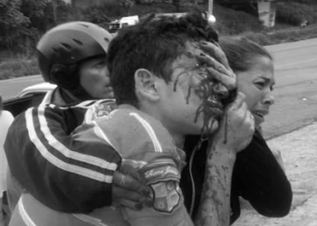 22 personas con disparos en sus ojos esperan justicia en Mérida