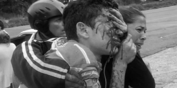 22 personas con disparos en sus ojos esperan justicia en Mérida