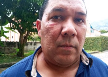 Oficialistas agredieron al candidato a Legislador por la Unidad Luis Millán en Mérida