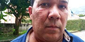 Oficialistas agredieron al candidato a Legislador por la Unidad Luis Millán en Mérida