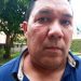 Oficialistas agredieron al candidato a Legislador por la Unidad Luis Millán en Mérida
