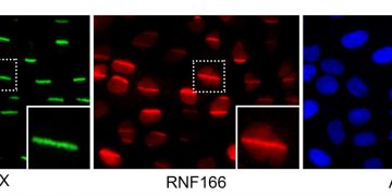 Visualizan la maquinaria de reparación del ADN a un detalle nunca antes visto