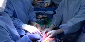 Logran trasplantar dos riñones de cerdo modificados genéticamente a un humano