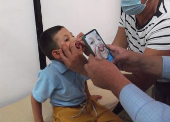 Funda Sit inició con éxito jornada para pacientes con hendidura labio palatina en Boconó