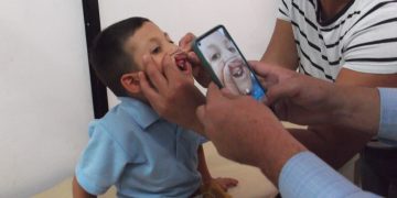 Funda Sit inició con éxito jornada para pacientes con hendidura labio palatina en Boconó