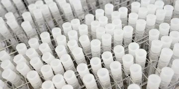 Hallan una conexión entre el metabolismo de la glucosa y los tumores colorrectales