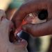La Academia de Medicina urge aumentar la vacunación contra la polio en Venezuela