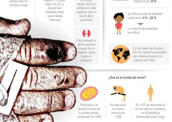 Los casos de viruela del mono suben a 20 en el Reino Unido