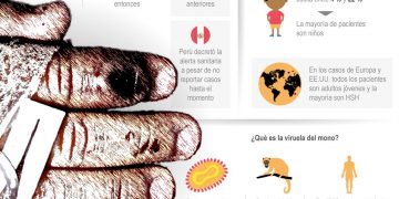 Los casos de viruela del mono suben a 20 en el Reino Unido