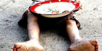 Desnutrición en Venezuela: una generación en desventaja (y II)