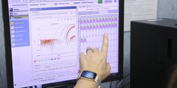 Venezuela detecta dos casos nuevos de viruela del mono