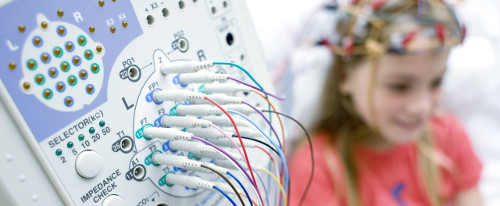 Penden de un hilo electroencefalogramas en hospital de Trujillo: Pacientes piden renovar equipos
