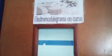 Penden de un hilo electroencefalogramas en hospital de Trujillo: Pacientes piden renovar equipos