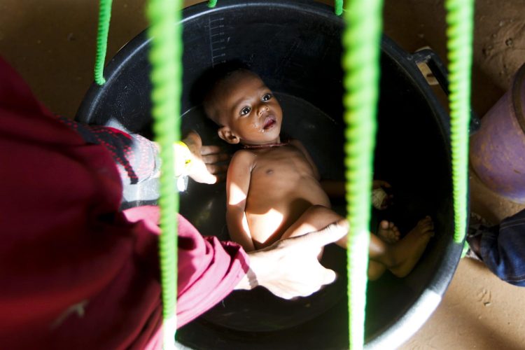 Fotografía de archivo de un niño somalí desnutrido es colocado dentro de un balde para ser pesado en una clínica administrada por Médicos Sin Fronteras (MSF). EFE/EPA/DAI KUROKAWA