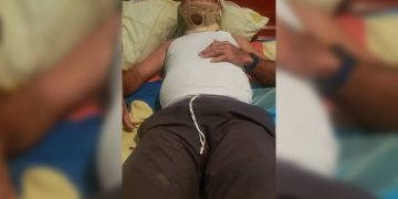 Obrero lesionado en trabajos de recuperación de la Torre de La Vichú no ha recibido apoyo financiero para recuperarse