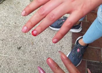 Al estilo medieval: Oficialistas arrancan las uñas a estudiantes de la ULA por reclamar el daño a la universidad
