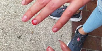 Al estilo medieval: Oficialistas arrancan las uñas a estudiantes de la ULA por reclamar el daño a la universidad