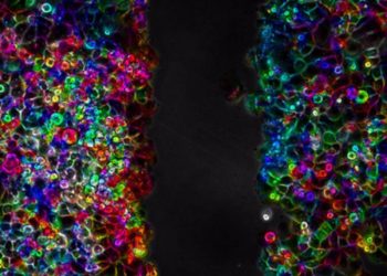 Científicas prueban terapia ultrasónica para combatir el cáncer de páncreas