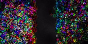 Científicas prueban terapia ultrasónica para combatir el cáncer de páncreas