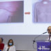 Hospital español practica el primer trasplante pulmonar robótico sin abrir el tórax