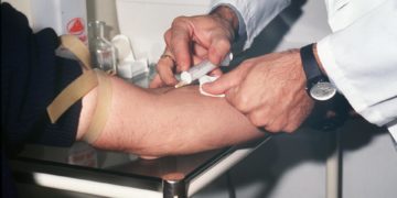 Científico hongkonés desarrolla un análisis de sangre para detectar células cancerígenas