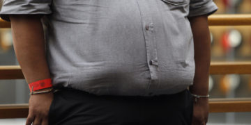 La obesidad, un factor de riesgo para el cáncer que varía según el sexo y el tipo de tumor