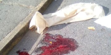 Localizan cadáver de un hombre en plena vía pública de Boconó