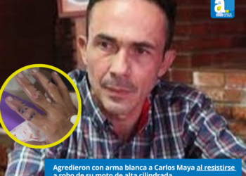 Agredieron con arma blanca a Carlos Maya al resistirse a robo de su moto de alta cilindrada