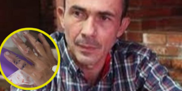 Agredieron con arma blanca a Carlos Maya al resistirse a robo de su moto de alta cilindrada