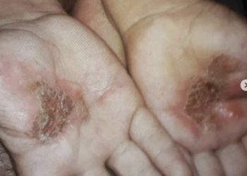 Piden al Fiscal General revisar el caso de maltrato infantil contra niño de tres años en El Vigía