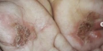 Piden al Fiscal General revisar el caso de maltrato infantil contra niño de tres años en El Vigía