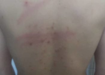 Brutal golpiza a cuatro presos políticos en Yare II exige respuesta inmediata